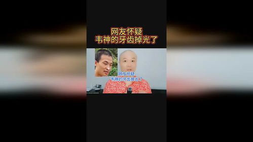 韦神的牙不是小事
